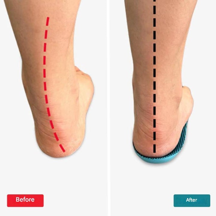 Orthopaedic Insoles – StepRelief