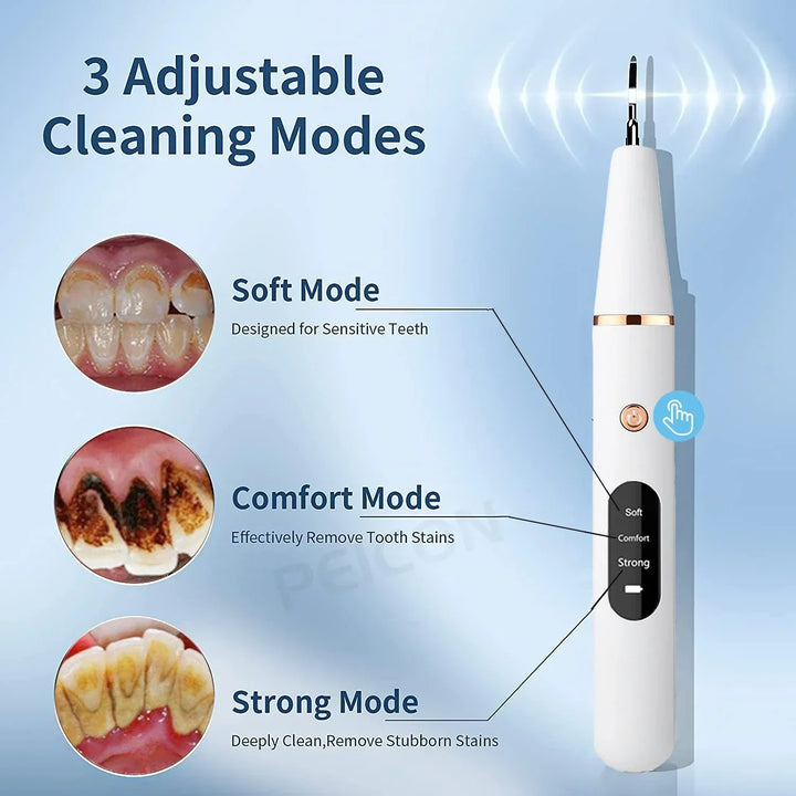 Ultrasonic Tooth Cleaner - SonicClean