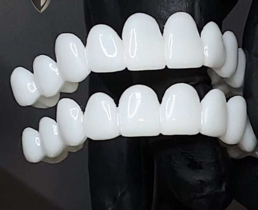 DentAlign Dental Veneers – Natural Fit and Comfort