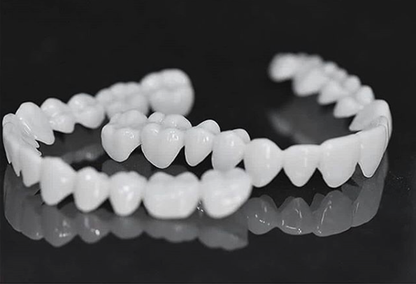 DentAlign Dental Veneers – Natural Fit and Comfort